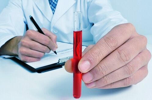 тест на крвта за да се идентификуваат паразити